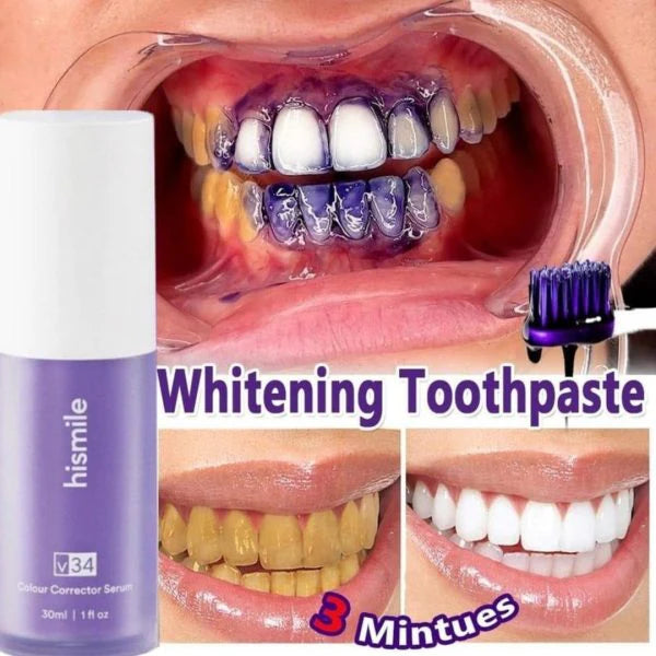 HiSmile v34 Teeth Whitening Serum